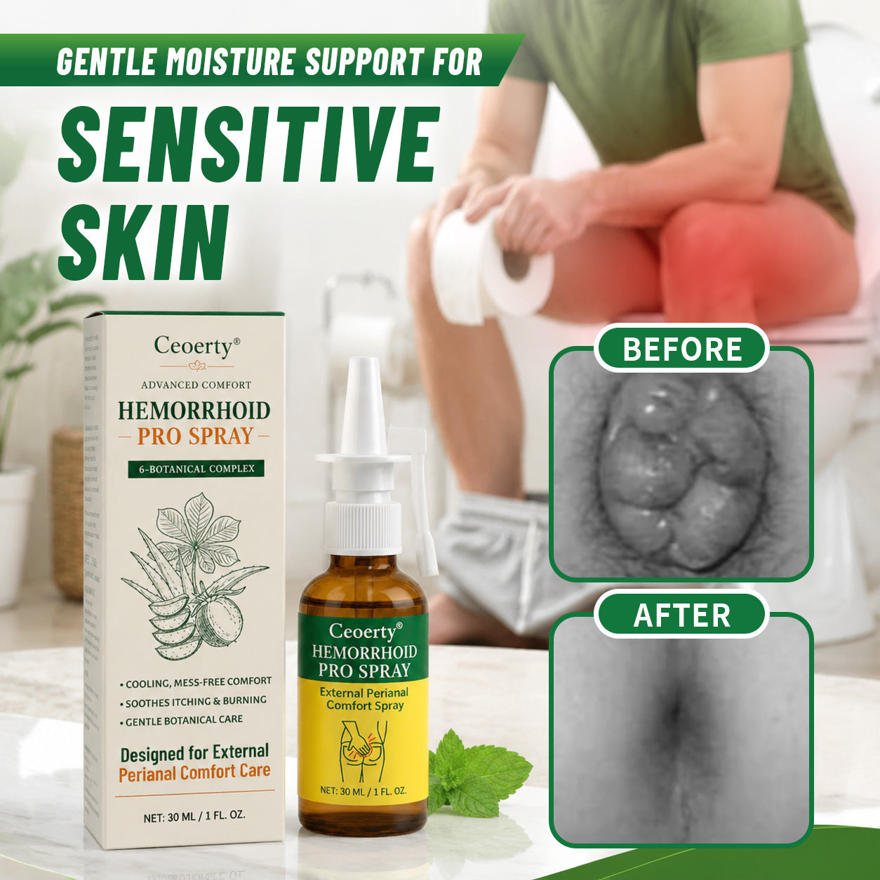 Ceoerty® Advanced Comfort Hemorrhoid PRO Spray✨